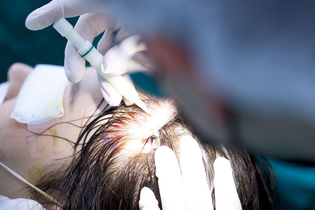 experting thanawin img 1