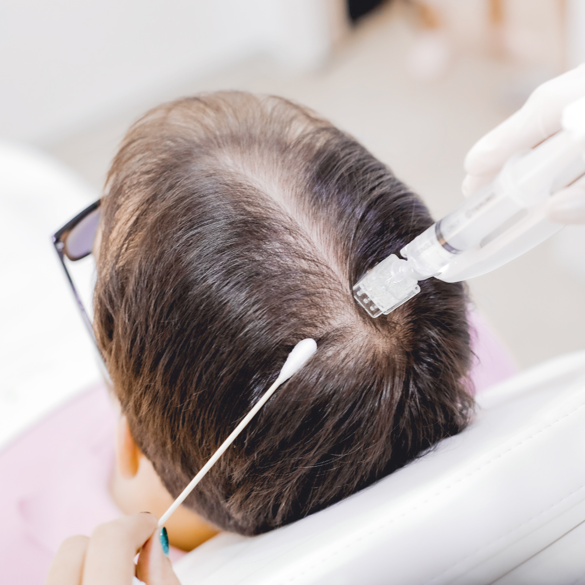 Micro Cell Hair Regrowth