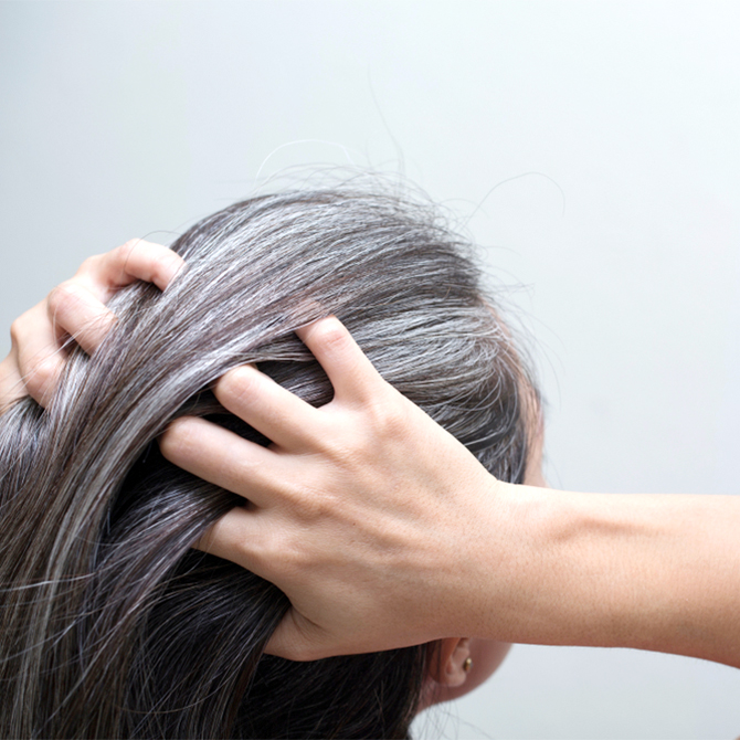 ผมหงอกก่อนวัย รักษาได้ไหม? หรือเป็นสัญญาณเตือนสุขภาพที่คุณไม่ควรมองข้าม!