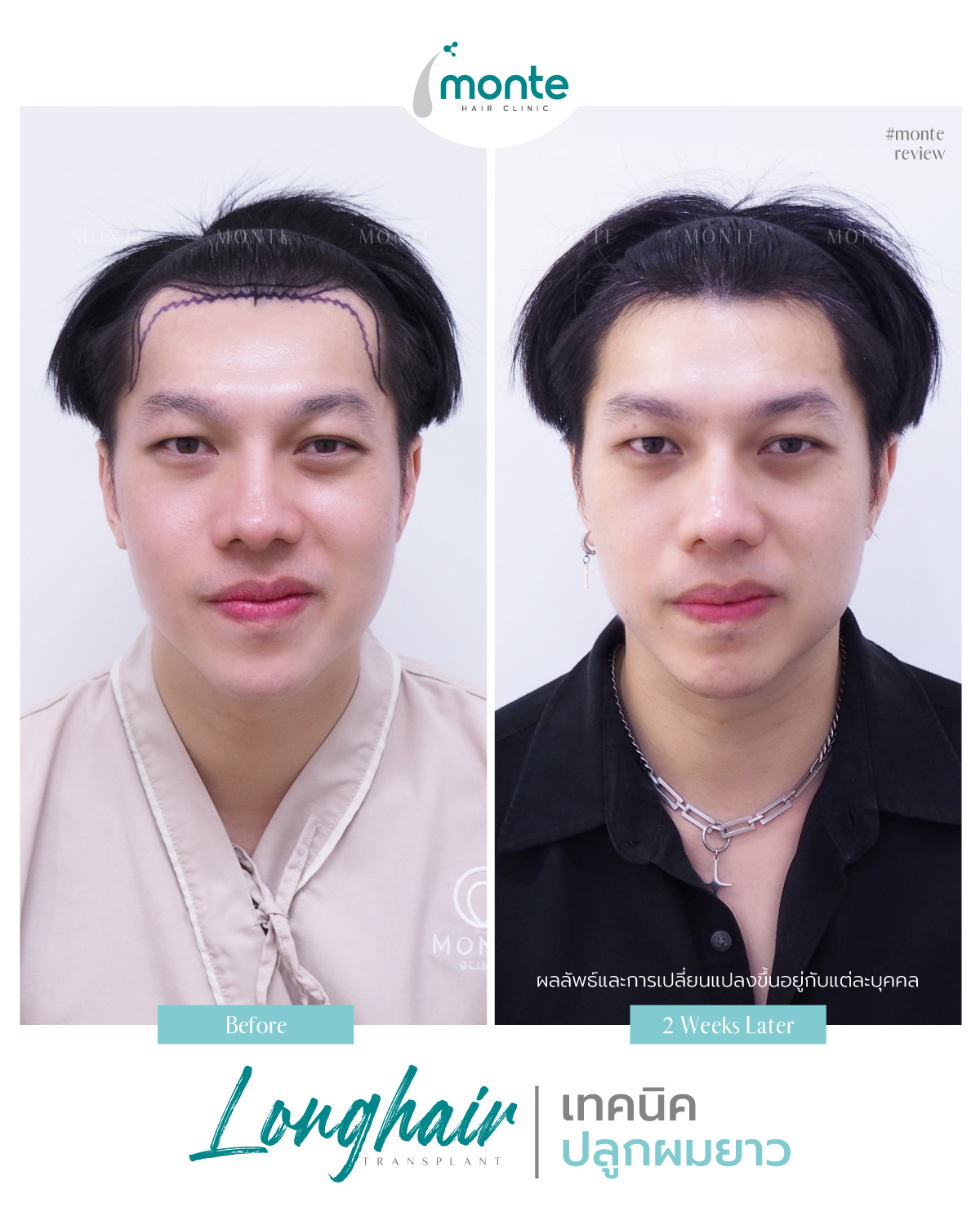 Testimonial 16 – LH กอล์ฟ