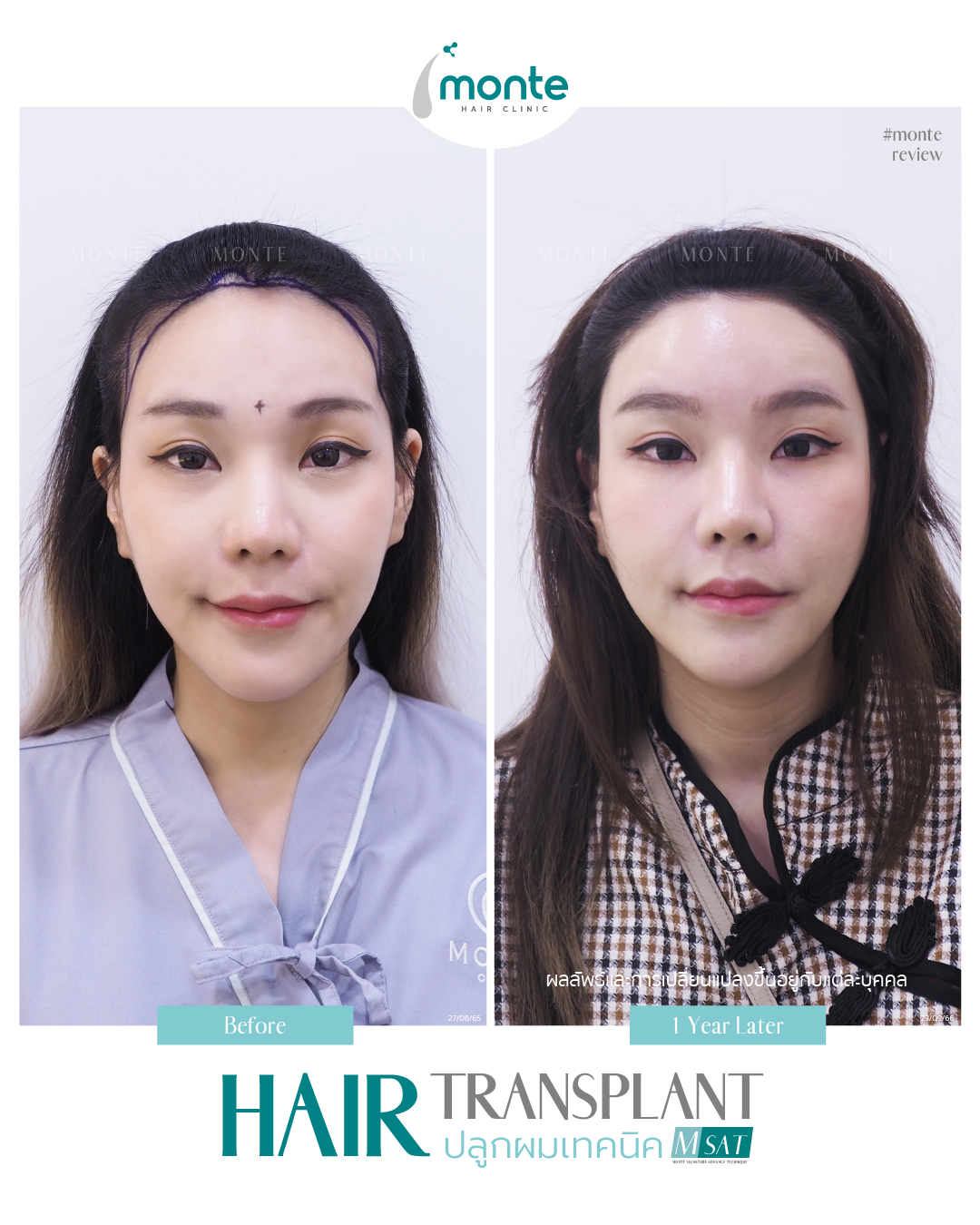 Testimonial 7 – MSAT ตุ้ยนุ้ย