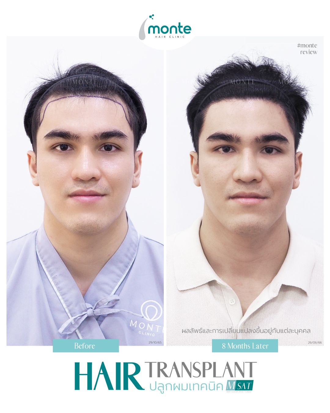 Testimonial 5 – MSAT นนท์