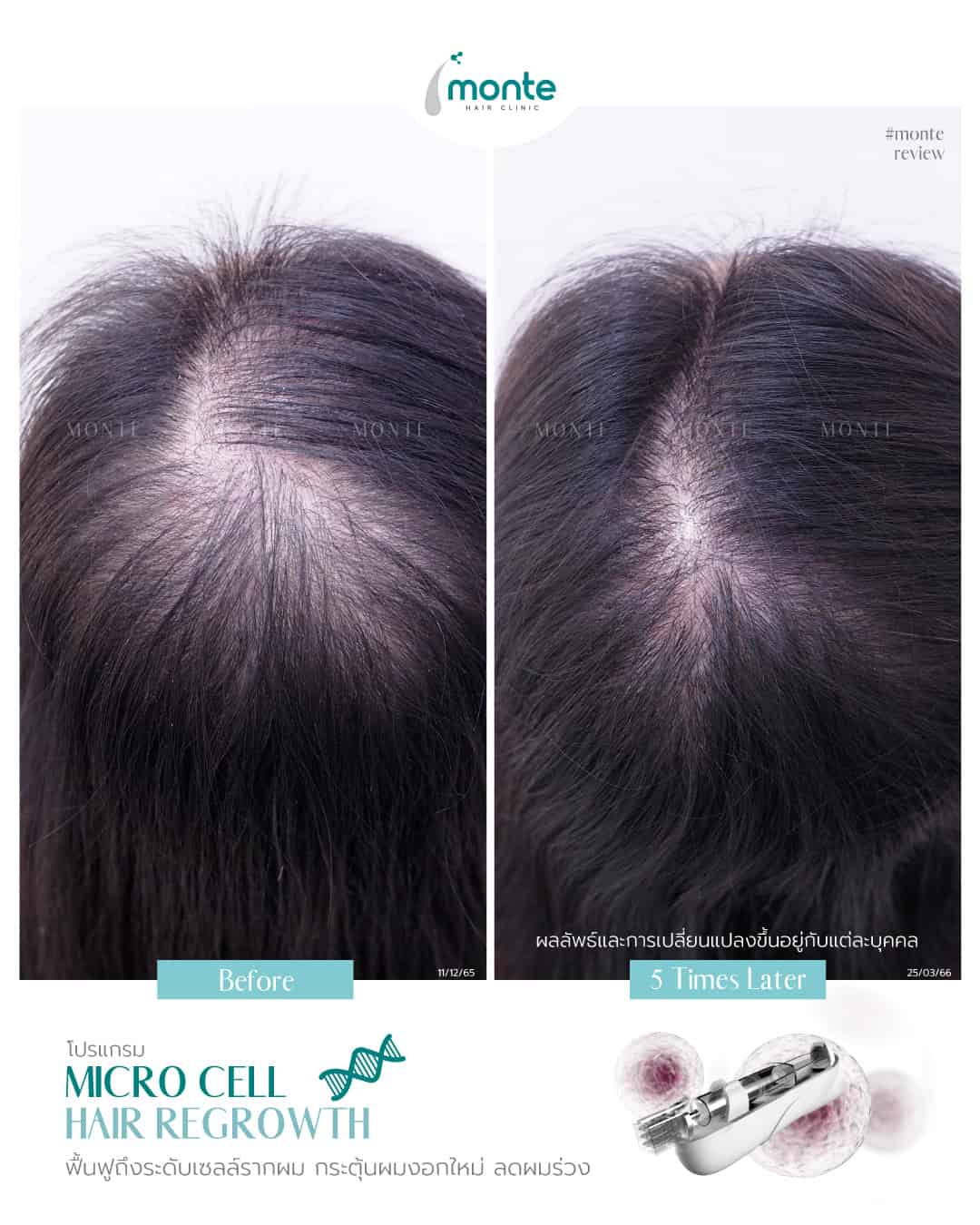 Testimonial 17 – Micro Cell