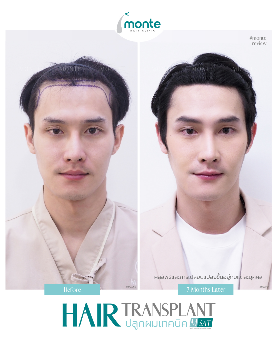 Testimonial 3 – MSAT เจมส์