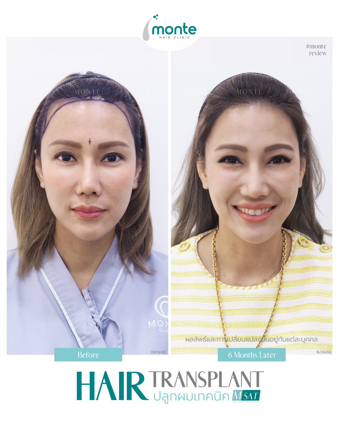 Testimonial 10 – MSAT เมนี่