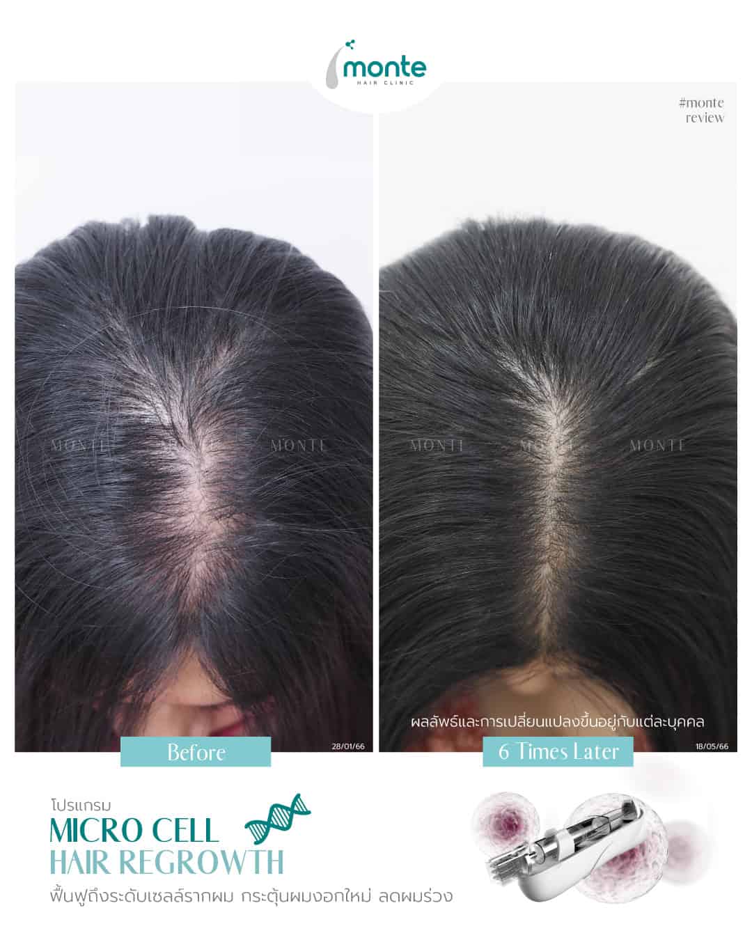 Testimonial 18 – Micro Cell