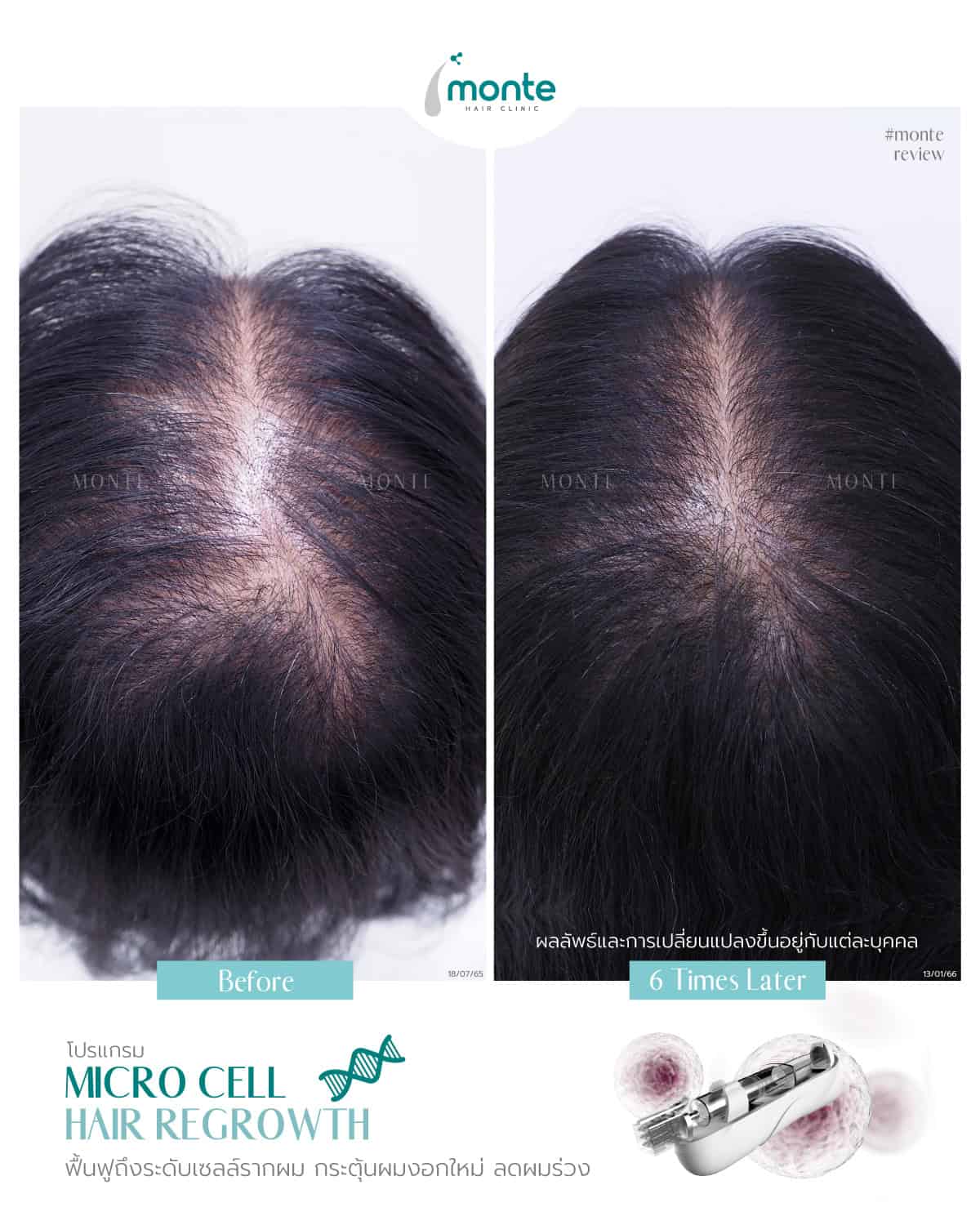 Testimonial 16 – Micro Cell