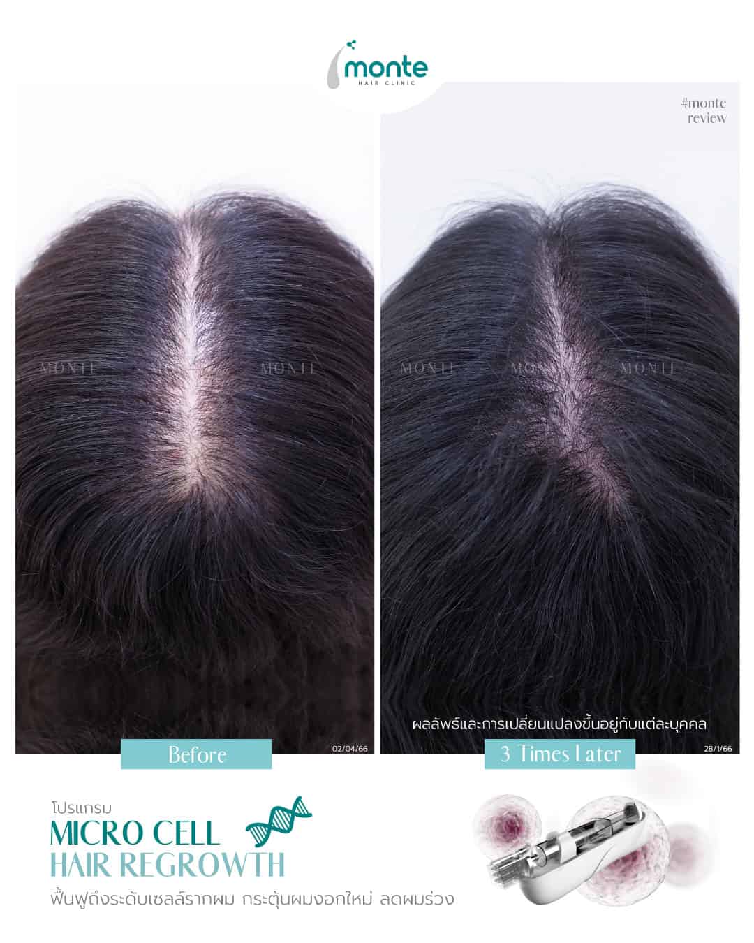 Testimonial 19 – Micro Cell