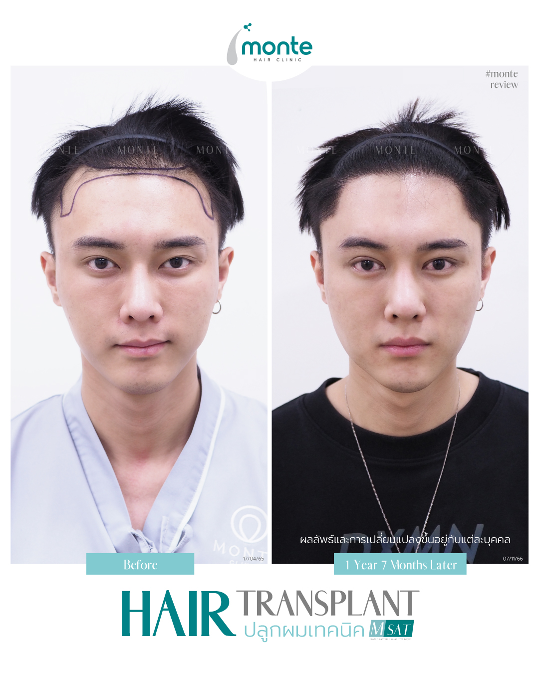 Testimonial 4 – MSAT โต้